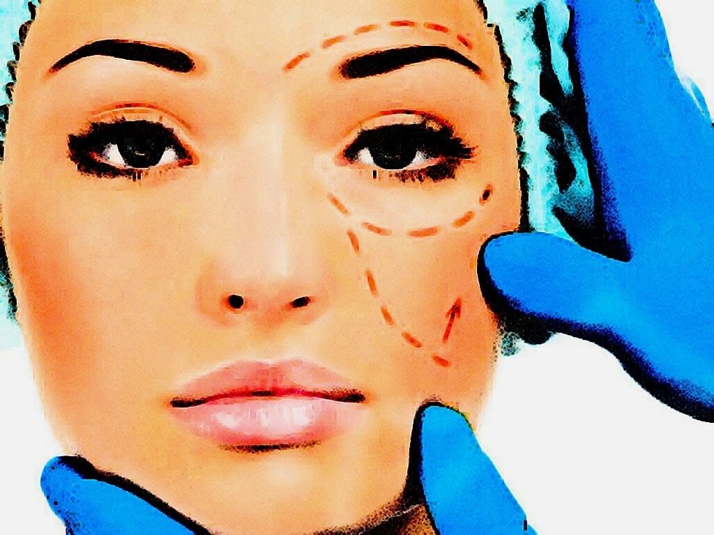Cosmetic Surgery