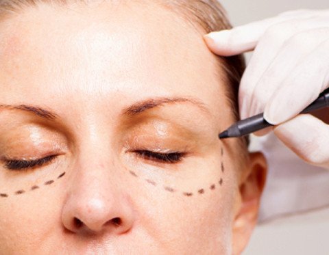 Blepharoplasty cost