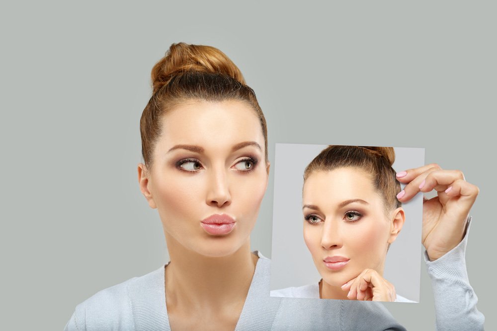 Rhinoplasty nose job