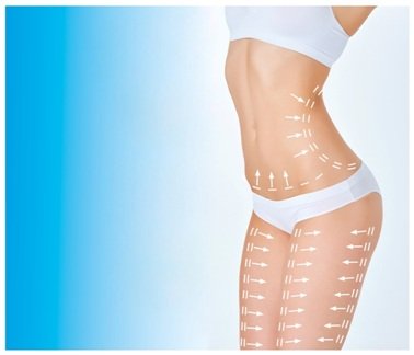 Liposuction