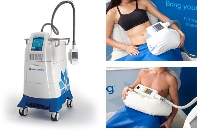 Coolsculpting Cryolipolysis