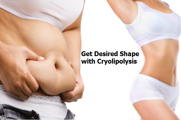 Cryolipolysis
