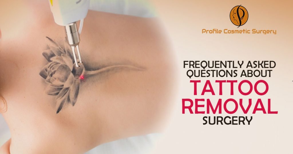 Frequently Asked Questions About Vitiligo