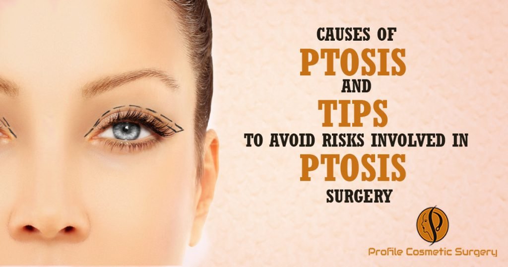 Hair Ptosis