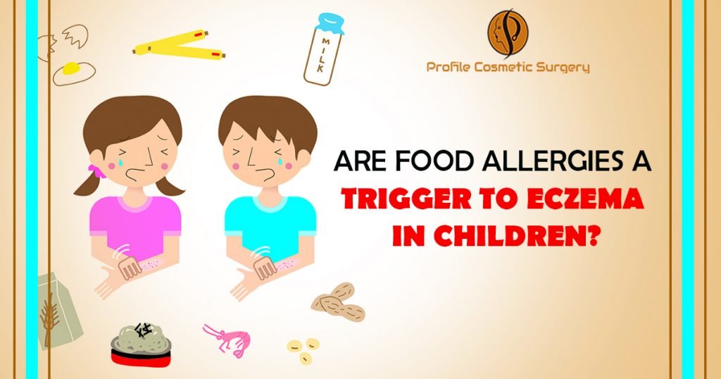 Are Food Allergies a Trigger to Eczema in Children