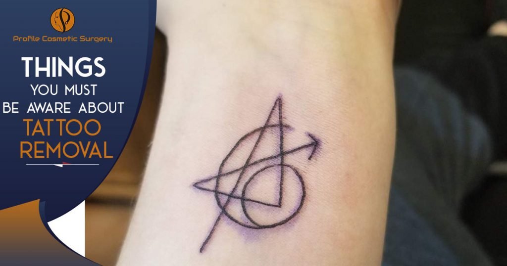 Things You must be aware about tattoo removal