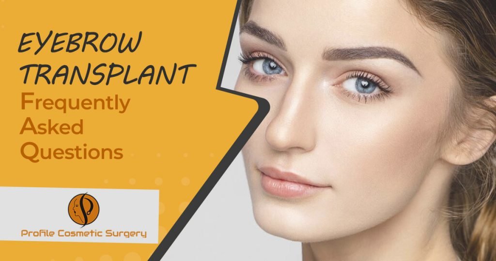 Eyebrow-Transplant-