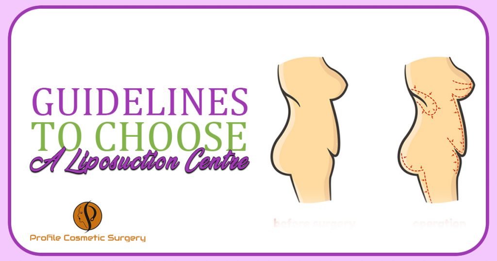 Guidelines to choose A Liposuction Centre