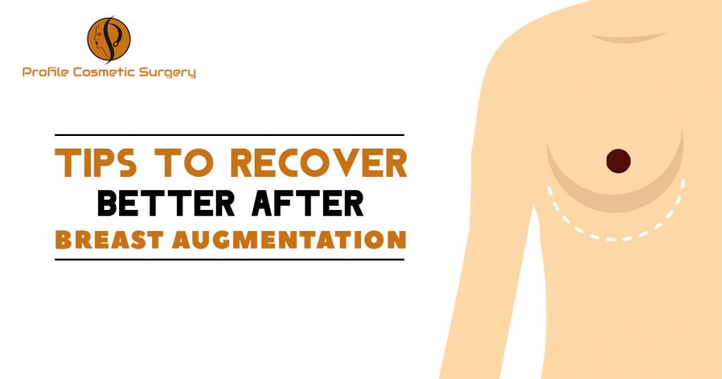 Tips to recovery better after Breast Augmentation