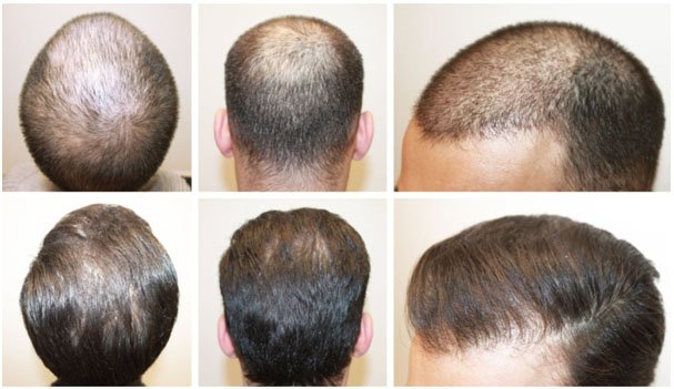 hair-men