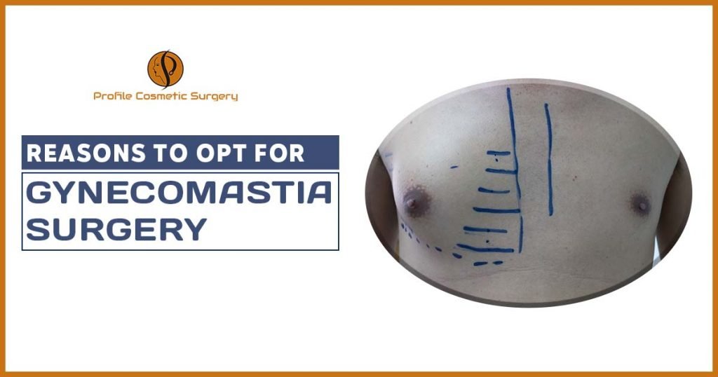 Reasons to opt for Gynecomastia surgery