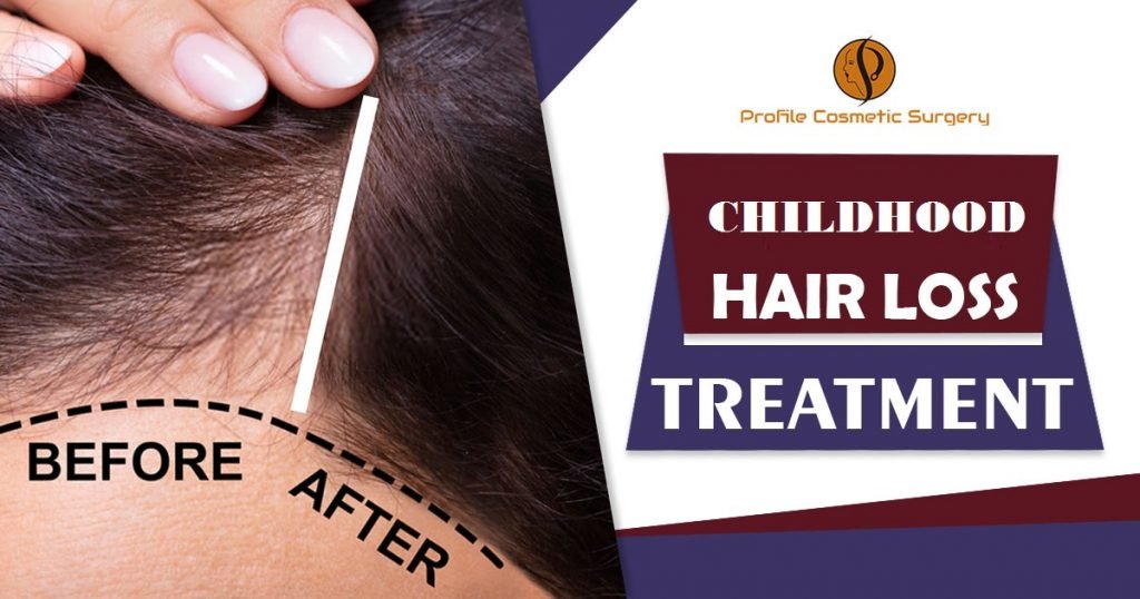 Childhood Hair Loss