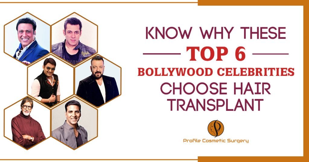 Know Why These Top 6 Bollywood Celebrities choose Hair Transplant