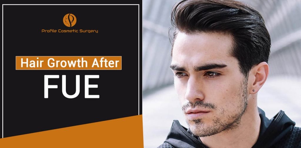 Hair growth after FUE Punjab