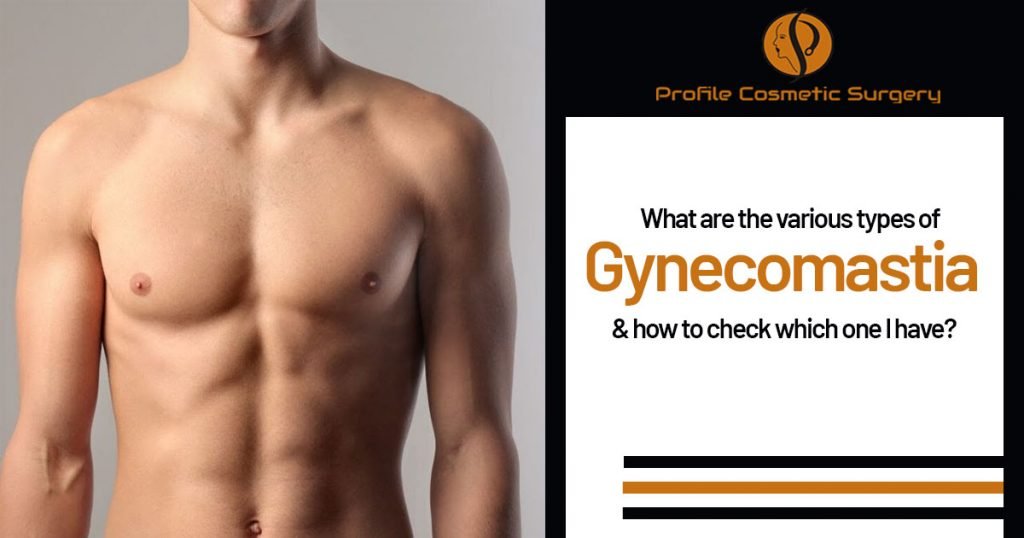 What are the various types of Gynecomastia and how to check which one I have