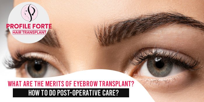 What are the merits of eyebrow transplant How to do post-operative care