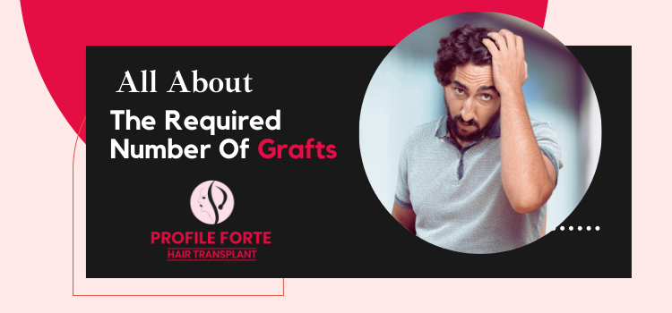 _All About The Required Number Of Grafts