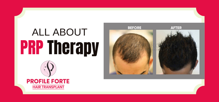 All about PRP therapy