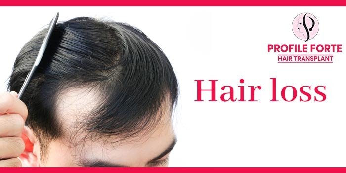 Hair-loss-at-the-Mid-20s