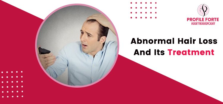 Abnormal Hair Loss And Its Treatment