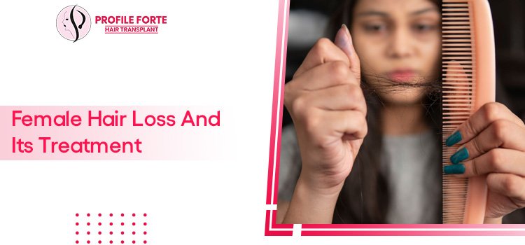 Female Hair Loss And Its Treatment