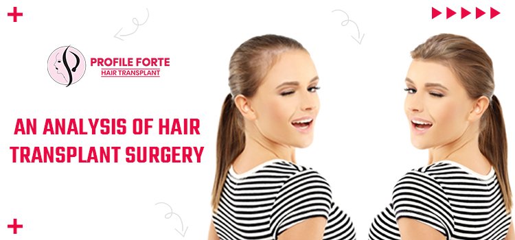 An Analysis Of Hair Transplant Surgery