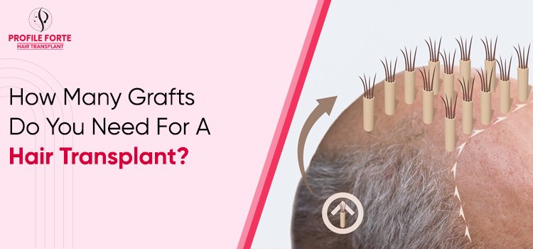 Hair-Transplant