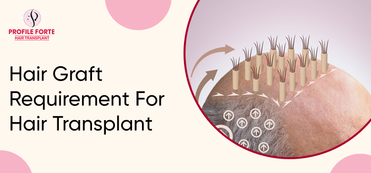 Hair Transplant