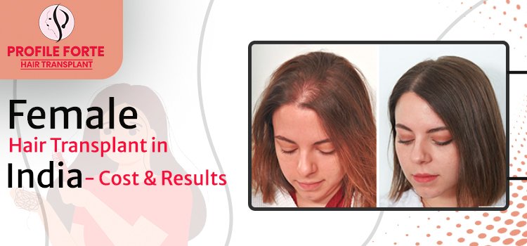 Female Hair Transplant in India